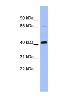 Properdin / CFP Antibody (aa35-84)