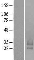 BRICD5 Protein (Over-Expression Lysate Myc-DDK (Flag))