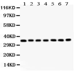 GNB2L1 / RACK1 Antibody (aa2-317)