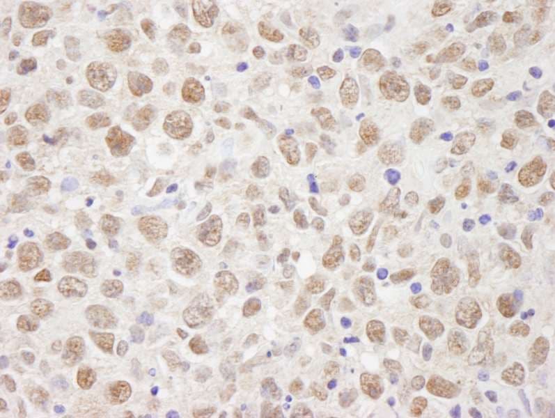 Polyclonal Rabbit anti-Human BRAT1 / BAAT1 Antibody (aa775-C-term, IHC)