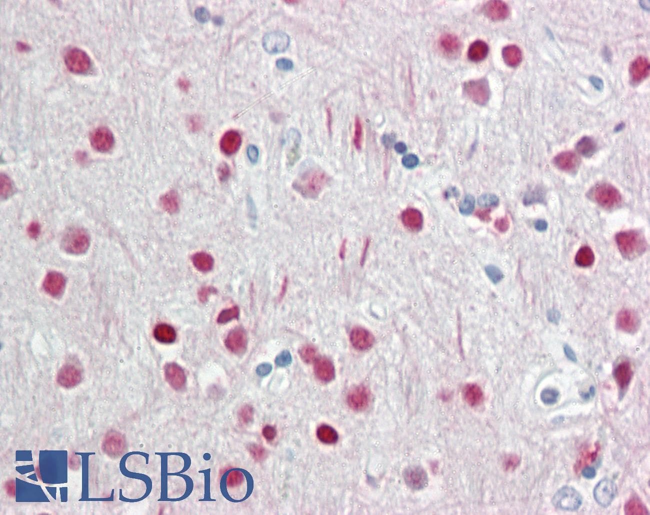IHC-plus™ WDR5 Antibody