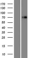 Human IDUA / MPS1 Protein (Over-Expression Lysate Myc-DDK (Flag))