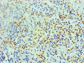 S100A8 / MRP8 Antibody (clone 1A1C1)