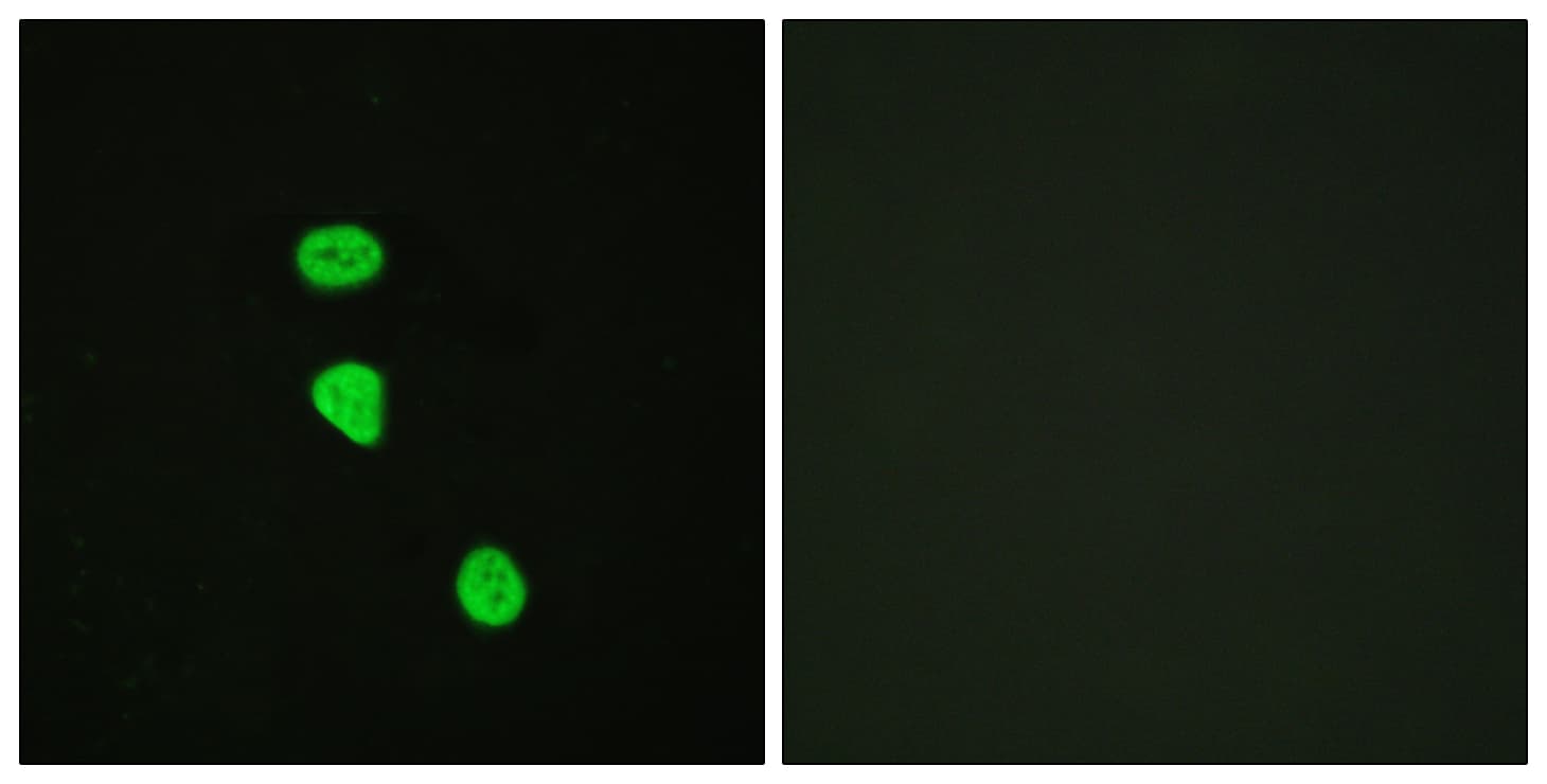 TBC1D4 / AS160 Antibody (phospho-Thr642)
