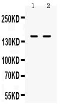 ITGAL / CD11a Antibody