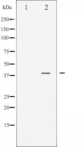 JUNB / JUN-B Antibody (phospho-Ser259)