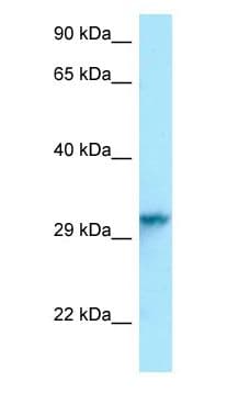 HNRNPC / HNRNP C Antibody (C-Terminus)