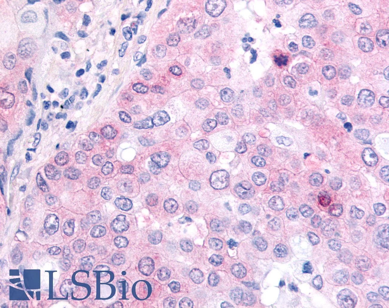 IHC-plus™ EGFR Antibody (C-Terminus)