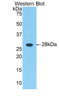 IRAK1 / IRAK Antibody (aa212-440)