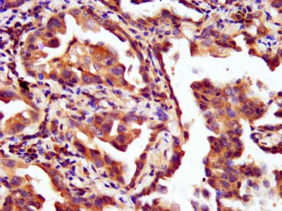 LAMC2 / Laminin Gamma 2 Antibody