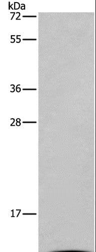Polyclonal Rabbit anti-Human I-BABP / FABP6 Antibody (IHC, WB)