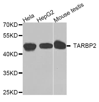 TARBP2 / TRBP2 Antibody