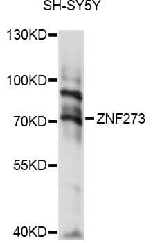 Polyclonal Rabbit anti-Human ZNF273 Antibody (WB)