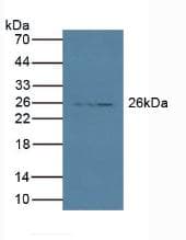PRSS2 / Trypsin 2 Antibody (aa24-241)