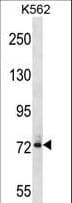 DNAI1 Antibody (aa92-120)