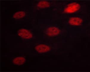 Polyclonal Rabbit anti-Human NFAT4 / NFATC3 Antibody (phospho-Ser165, IF, WB)