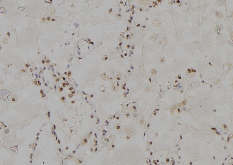 PSMC3 Antibody