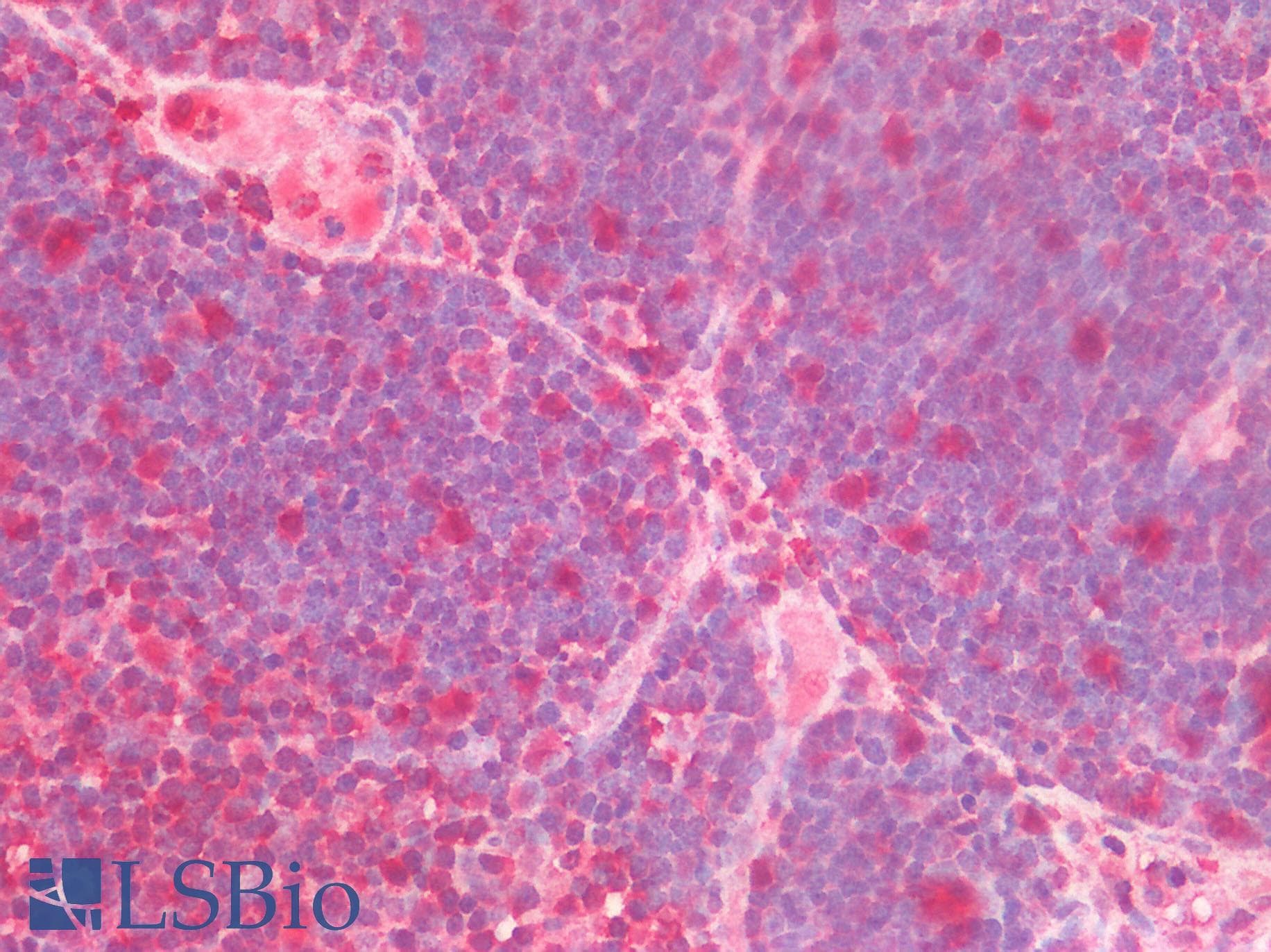 DGKA Antibody