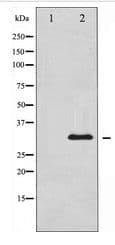 BCL2L1 / BCL-XL Antibody