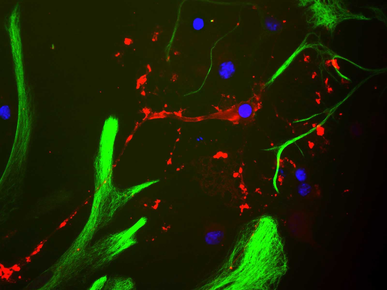 MBP / Myelin Basic Protein Antibody