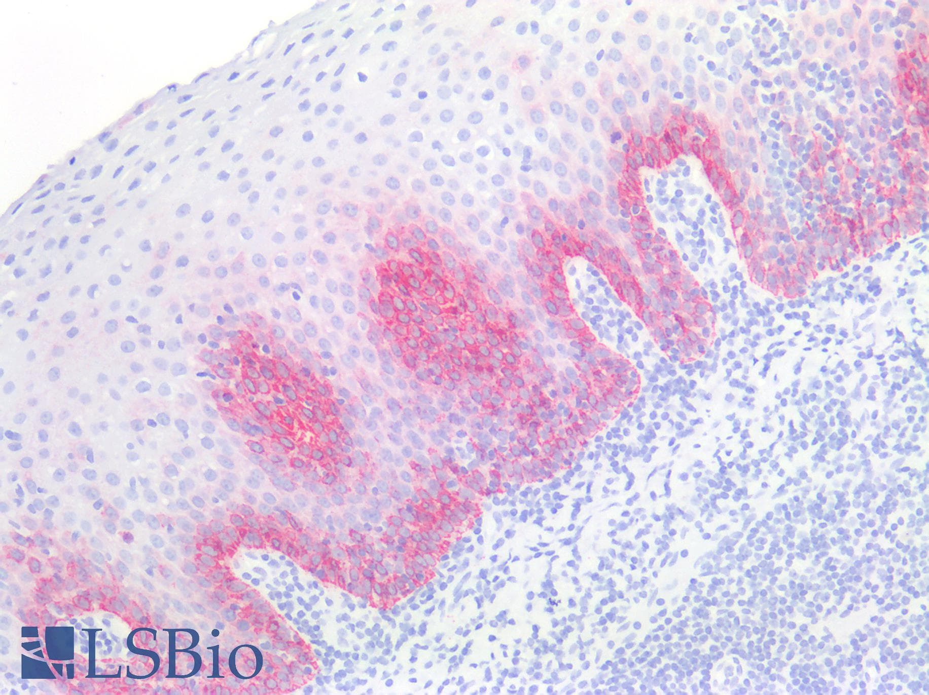 IHC-plus™ Monoclonal Mouse anti-Human KRT14 / CK14 / Cytokeratin 14 Antibody (clone AT13F4, IHC, IF, WB)