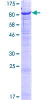 Human GLB1L2 Protein (Recombinant GST)