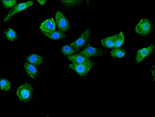BAIAP2 / IRSP53 Antibody