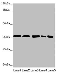 Polyclonal Rabbit anti-Human GNB2 Antibody (IHC, WB)