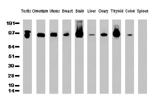 PECAM-1 / CD31 Antibody (clone UMAB29)