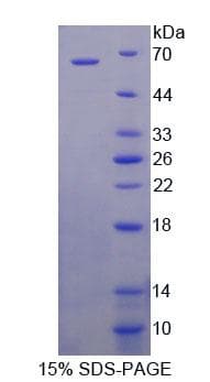 Mouse TXLNA / Alpha Taxilin Protein (Recombinant His-GST)