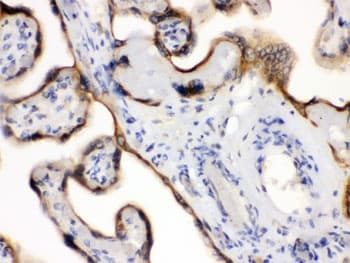 EDNRB / Endothelin B Receptor Antibody