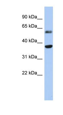 RDH10 Antibody (aa71-120)