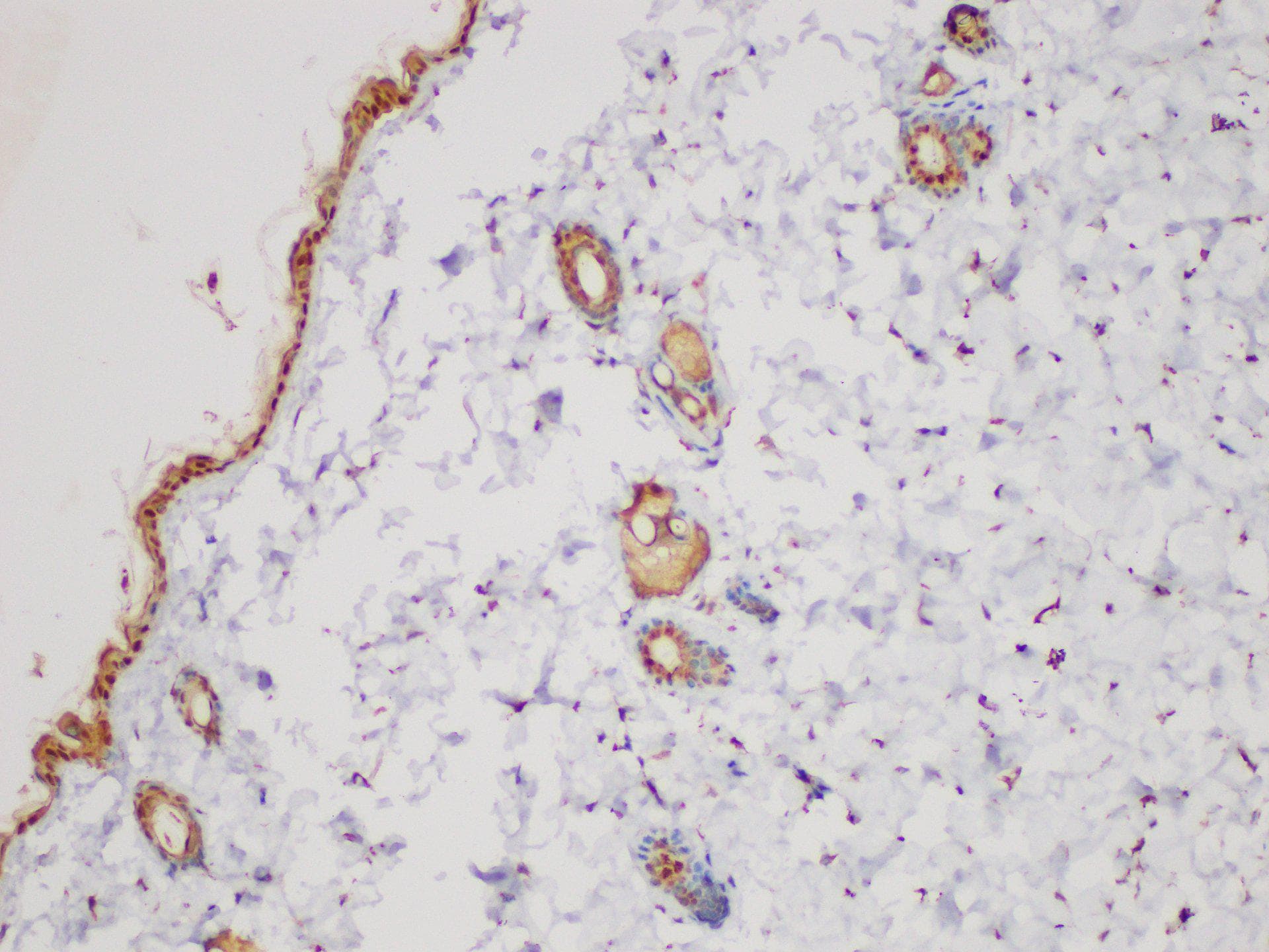 SERPINB2 / PAI-2 Antibody
