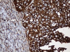 PAI-RBP1 / SERBP1 Antibody (aa1-262, clone OTI2C11)