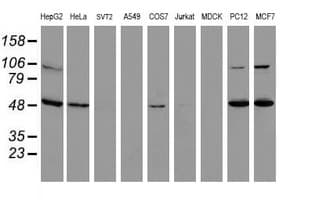 Monoclonal Mouse anti-Human ITFG2 Antibody (clone OTI3A3, IHC, WB)