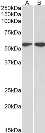 PathPlus™ Vimentin Antibody