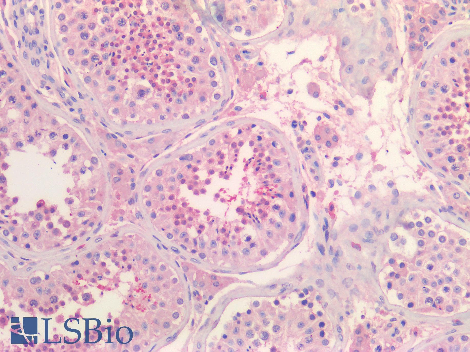 IHC-plus™ ADORA2A/Adenosine A2A Receptor Antibody