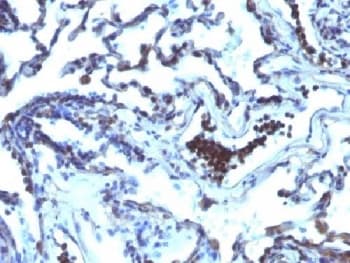 TDP2 / TTRAP Antibody (clone TDP2/1258)