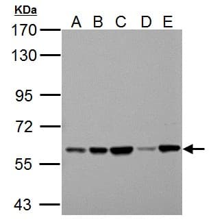 PKLR Antibody (aa1-260)