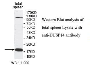 Polyclonal Rabbit anti-Human DUSP14 Antibody (aa2-198, IHC, WB)