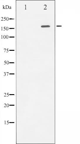 ROCK2 Antibody