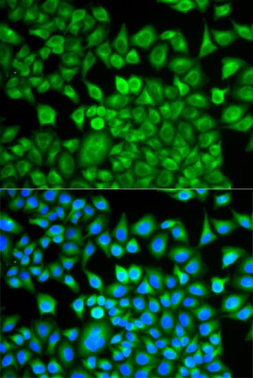 FABP1 / L-FABP Antibody