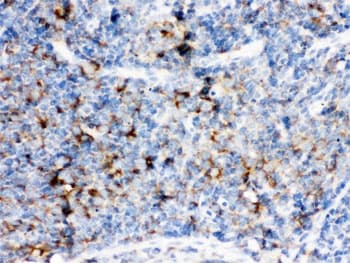 CD14 Antibody