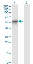 Monoclonal Mouse anti-Human KRT13 / CK13 / Cytokeratin 13 Antibody (clone 4F5, WB)