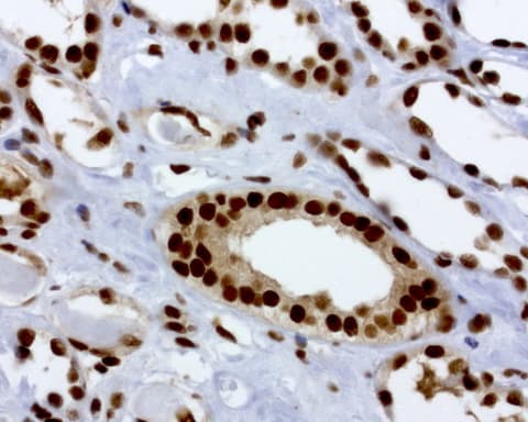 Monoclonal Mouse anti-Human C14orf166 Antibody (clone UMAB181, IHC, IF, WB)