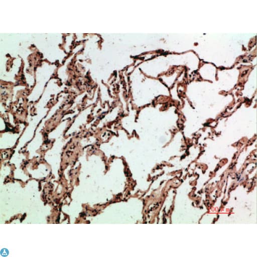 Polyclonal Rabbit anti-Human ADI1 / ARD Antibody (IHC)