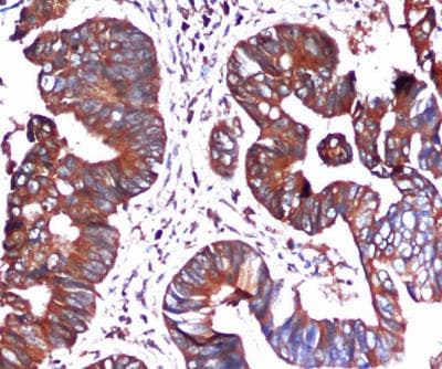 Monoclonal Mouse anti-Human HSPA5 / GRP78 / BiP Antibody (IHC, WB)
