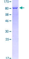 Human PDLIM5 / LIM Protein (Recombinant GST)