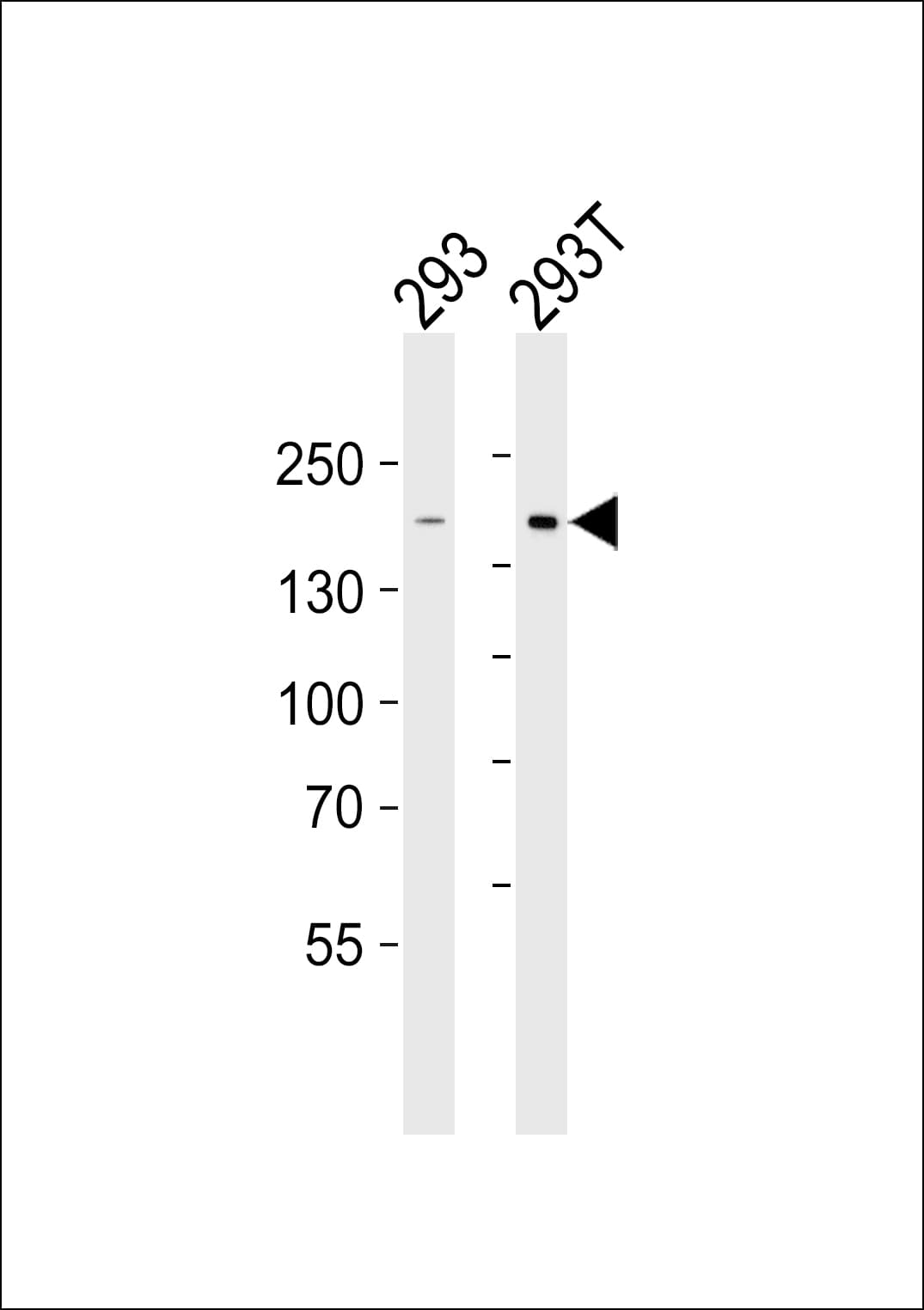 DIAPH1 Antibody (aa18-52)
