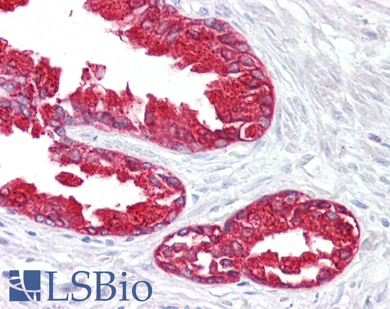 PathPlus™ ACPP / PAP Antibody (aa313-341)